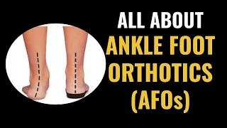 Types of AFOs (Ankle Foot Orthotics) for common foot conditions