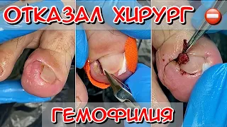 Отказал хирург / Что делать? Гемофилия / Вросший ноготь на ноге /