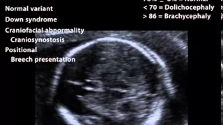 Fetal Biometery