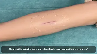 WOUND FREE Hydrogel Wound Dressings