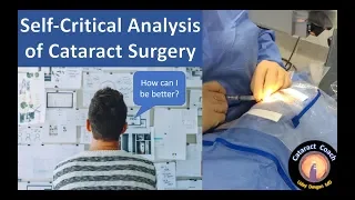 self-critical analysis of cataract surgery - the key to becoming a better surgeon