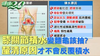 膝關節積水變麵龜該抽？ 釐清原因才不會反覆積水 健康2.0