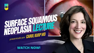 Ocular Surface Squamous Neoplasia Lecture - Carol Karp, MD