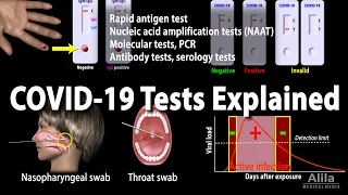 Understanding Different COVID-19 Tests, Animation