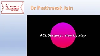 Steps of ACL Reconstruction (external)