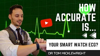 How accurate is your smart watch ECG? Doctor's analysis of the wearable tech and the evidence