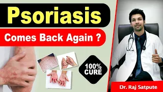 Psoriasis Will Never Come Back Again 100% Permanent Cure | Is Psoriasis Curable ? Dr. Raj Satpute