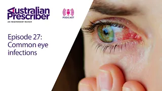 Episode 27 – Common eye infections