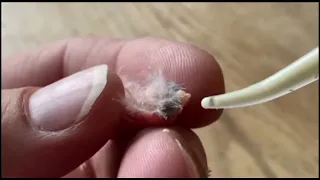 The Tiniest Bird You've Ever Seen-Zebra Finch Hatching: watch till end it is really amazing😍😱😱