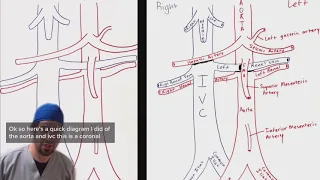 Aorta and IVC breakdown for ultrasound