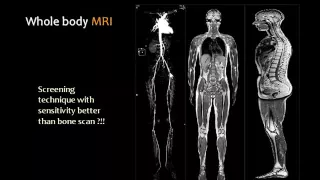 Imaging of Bone tumors   For non Arab