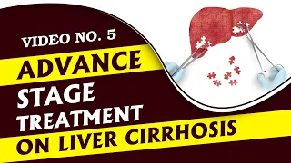 Symptoms, Causes and Complication of Advanced Liver Cirrhosis in Hindi | Diet and Exercise