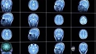 Atheist Neurosurgeon  says heaven is real