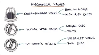 Prosthetic Heart Valves: Visual Explanation for Students