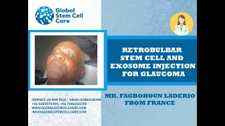 Retrobulbar Stem Cell and Exosome injection for Glaucoma | Vision Loss | Stem Cell | GSCC