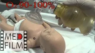 Реанимация новорожденных в родильном зале © Neonatal resuscitation