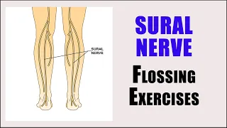 SURAL NERVE ENTRAPMENT | Nerve glide exercises for pain, numbness and tingling in the leg and foot