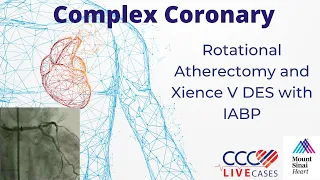 Rotational Atherectomy and Xience V DES with IABP - November 17, 2009 Webcast Video