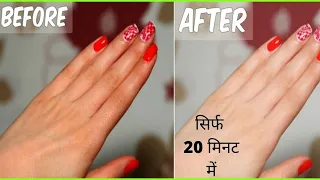 How To Remove Tan From Face,Neck,Hands,Knees Overnight| Simple home remedie