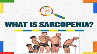 Sarcopenia: Taking Charge of Your Muscle Health As You Age #diatube #sarcopenia #healthprograme