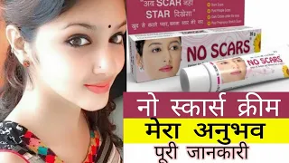 No Scars Cream Remove| Face pigmentation| Melasma | Acne & Pimples Marks | Review In Hindi