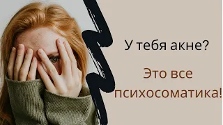 ВСЕ БОЛЕЗНИ ОТ НЕРВОВ? АКНЕ И ПСИХОСОМАТИКА - Прямой эфир