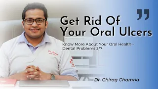 Get Rid OF Oral Ulcers | Dental Problems 3/7 | Dr Chirag Chamria | Mouth Hygiene