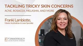 Tackling Tricky Skin Concerns | Acne, Rosacea, Melasma, and more