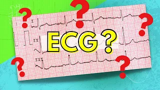 How to Read an Electrocardiogram (ECG/EKG)