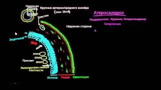 Атеросклероз, часть 1