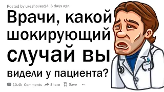 Врачи, какой самый шокирующий случай “о, я думал, что это нормально” вы видели у пациента?