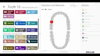 Introduction to Exocad program Very Easy