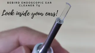 Xiaomi BEEBIRD T5 Ear Endoscopic Cleaner! Look Inside your Ears!