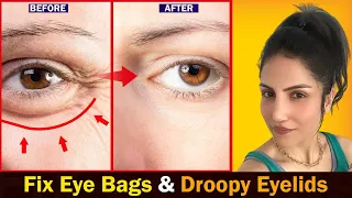 Fix Eye Bags & Droopy Eyelids with Face Yoga | Face Yoga for Eyes | #faceyoga