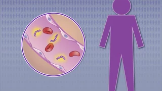 Detecting Nasopharyngeal Carcinoma in Asymptomatic Persons