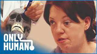 Removing the Face Growth That Could Be Damaging My Brain | Medical Documentary | Only Human