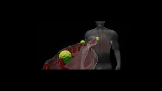 Lung infection by coronavirus in 3D animation #shorts