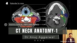 CT Neck Anatomy (Radiology Basics)| Anuj Aggarwal