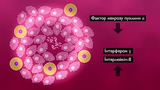 Латентна туберкульозна інфекція і туберкульоз (тема №1)