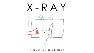 X-ray Scanning - A-level Physics
