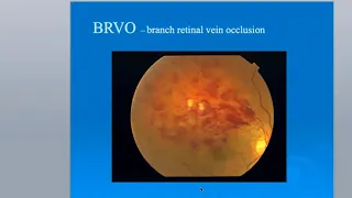 Lecture Eye and Systemic Diseases