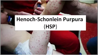 Henoch-Schonlein Purpura (HSP)