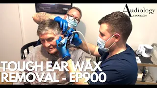 TOUGH EAR WAX REMOVAL IT TOOK BOTH OF US TO REMOVE ! - EP900