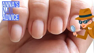 Soft & Peeling Nails, WHY?! [ANNA'S NAIL ADVICE]