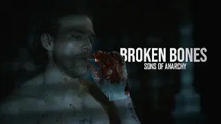 Sons of Anarchy || Broken Bones