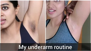 How I Got Rid of My Dark Underarms