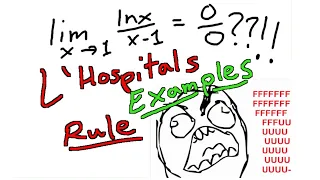 L'Hospital's Rule - Limits Examples