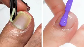 #522 15+ Nail Art Compilation | Trending Nail Art Designs for 2022