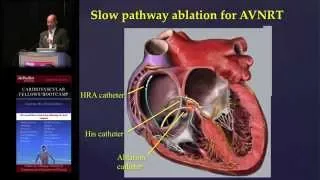 Survival EKG! Narrow and Wide Complex Tachycardias (Miguel Valderrábano, MD)