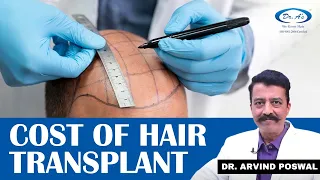 👉What is The Cost of Hair Transplant?| How long do Transplanted Hair last?| Hair Transplant In Hindi